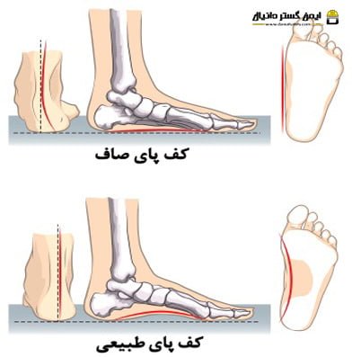 چکمه های نظامی باعث صافی کف پا میشود؟